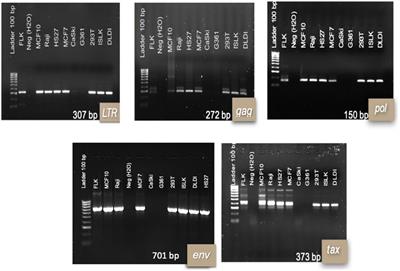 In vitro Susceptibility of Human Cell Lines Infection by Bovine Leukemia Virus